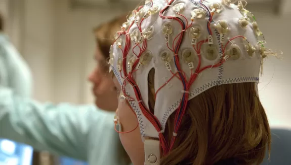 A child with electrodes on their head for a brain scan